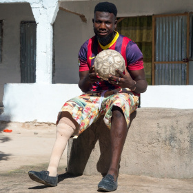 A young man is sat on a slab of concrete holding a football in his hands. He is wearing shorts and one of his legs is prosthetic. 